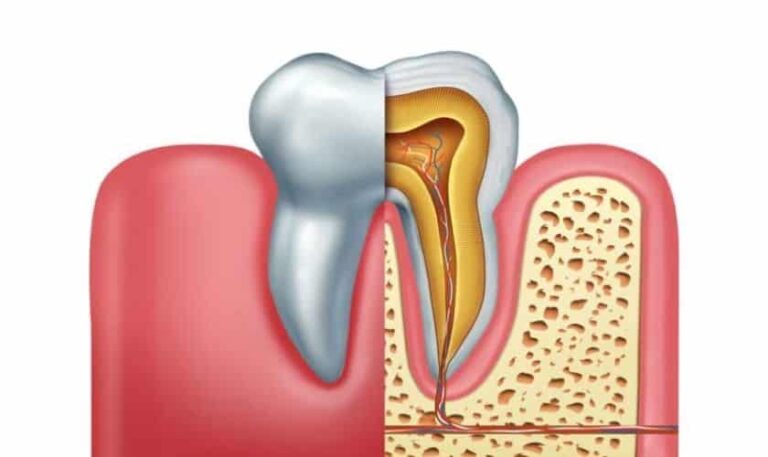 4 Common Symptoms That You Might Have A Root Canal Infection